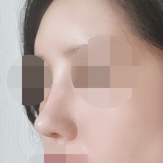 before photo: 엘라비에리투오