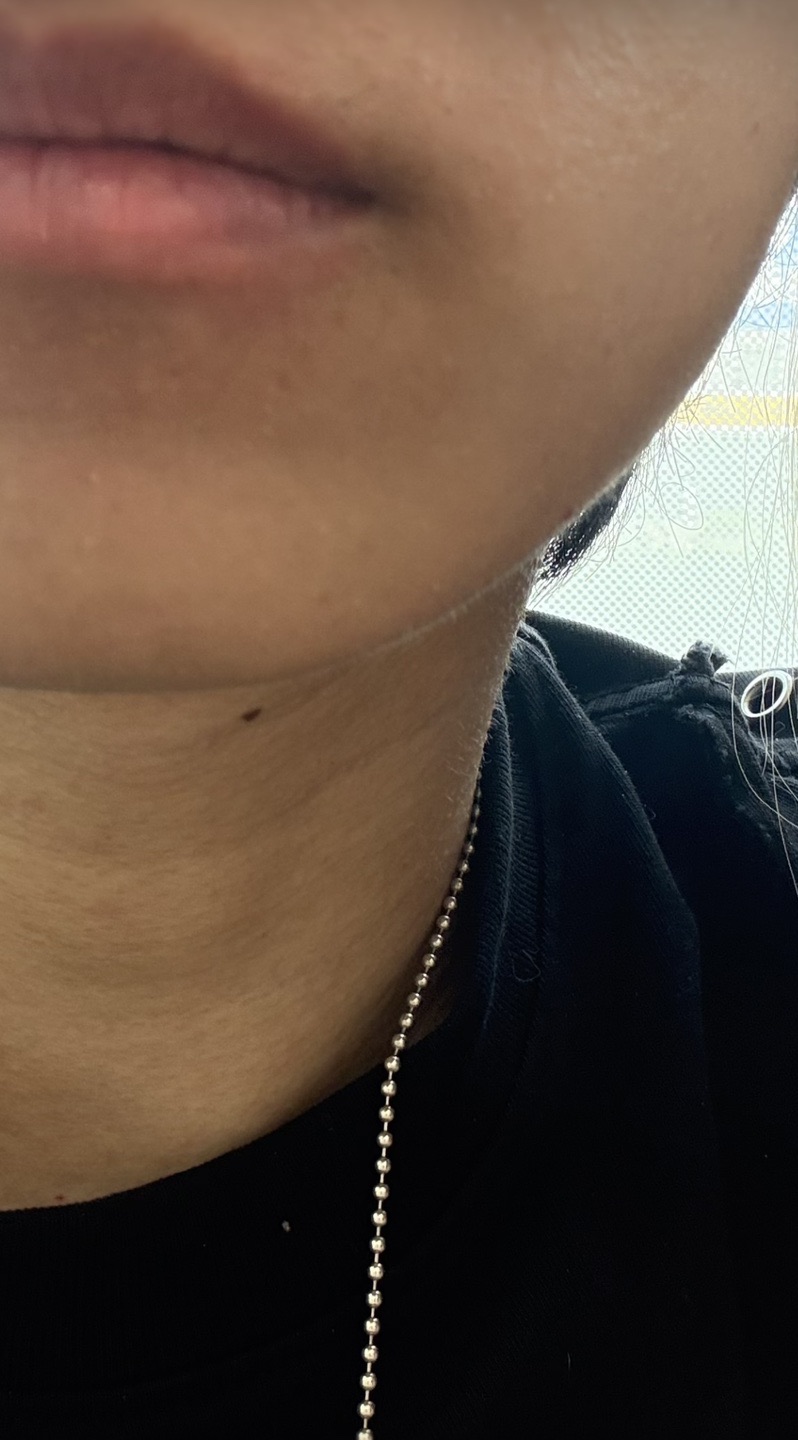 2023年最新エレクトロポレーション ハイドラフェイシャル 2023年最新