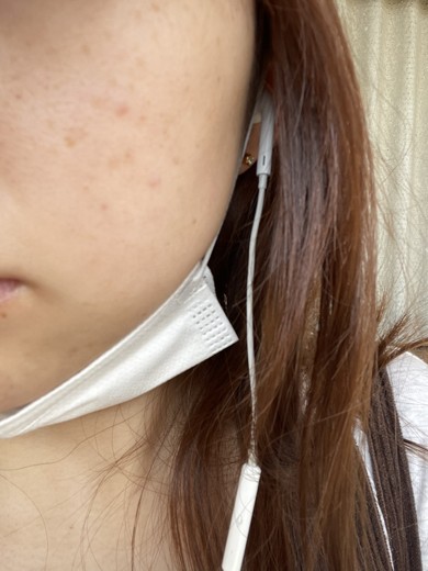 before photo: IPL(光/フォト治療), 診断・検査