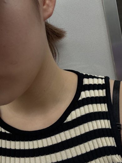 before photo: ジュベルック(Juvelook)