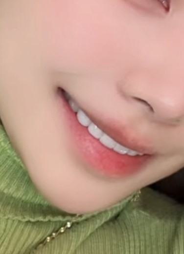 after photo: 라미네이트