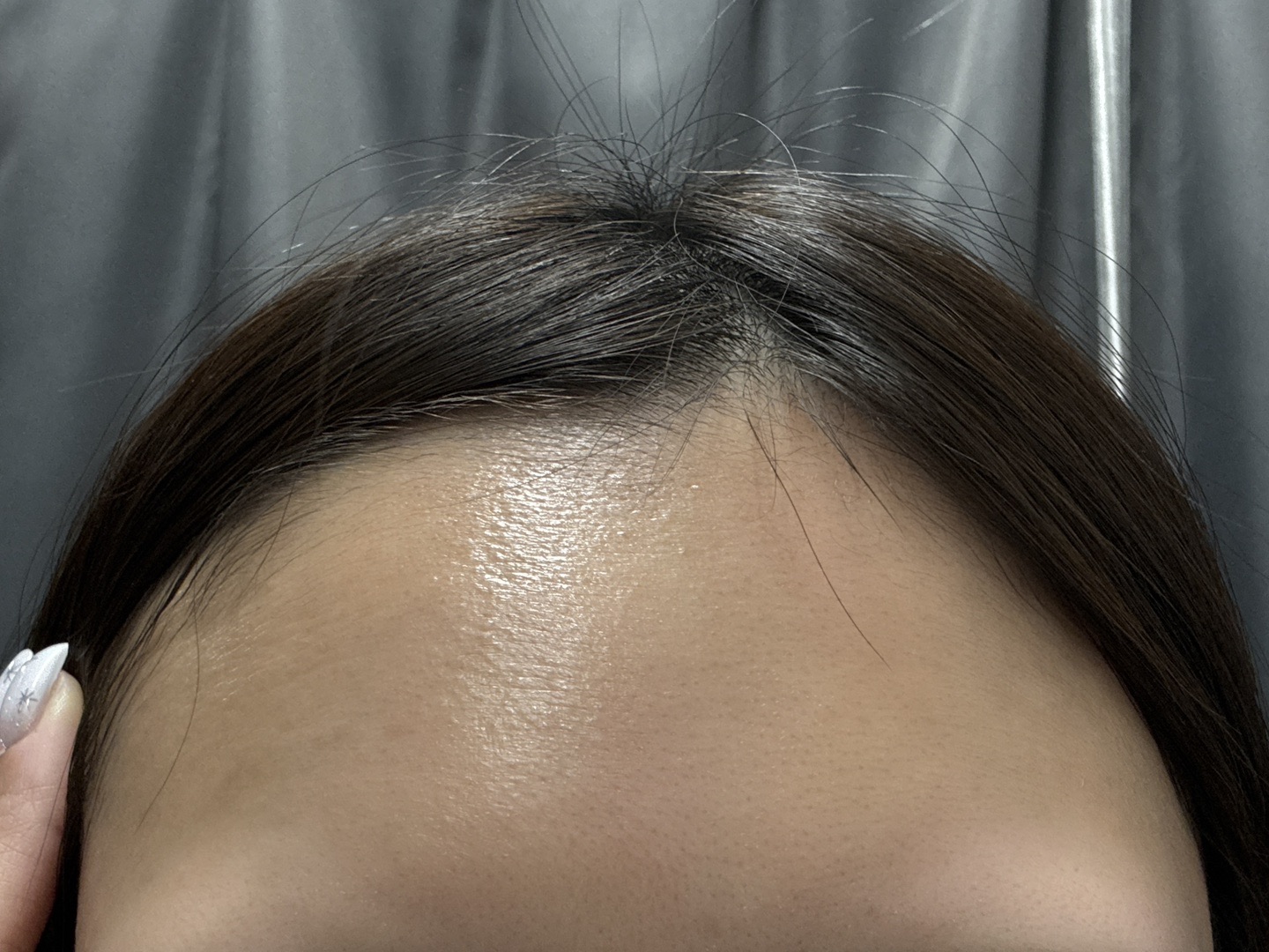 マッサージピール | BISIN GINZA CLINIC （ビシンギンザクリニック）