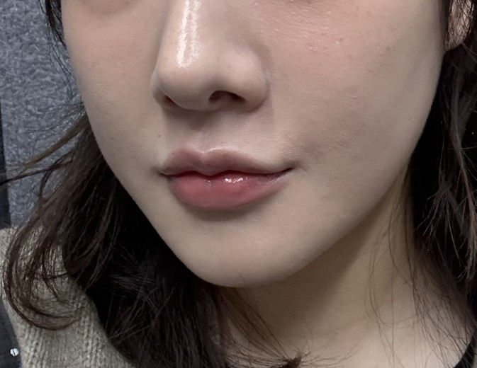 after photo: 쥬베룩