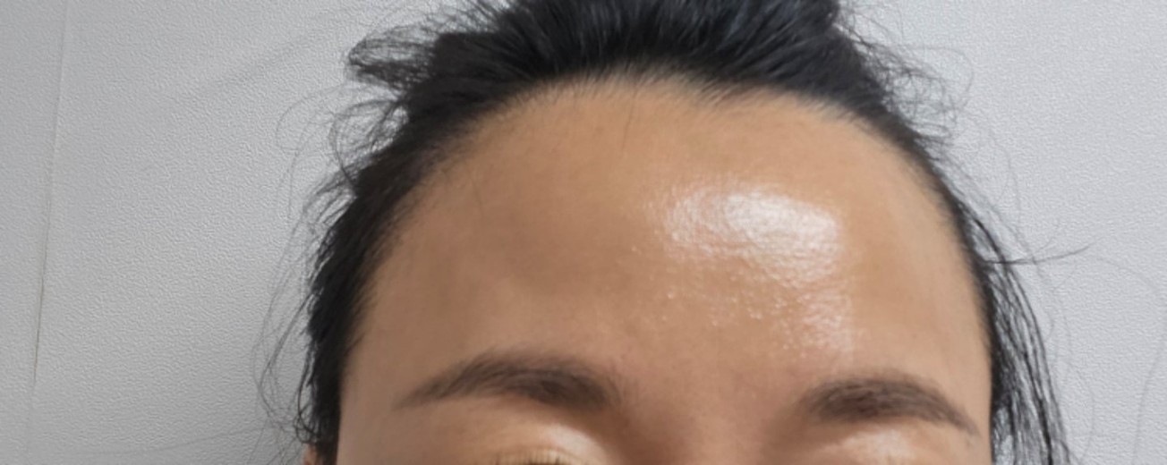 before photo: 라라필