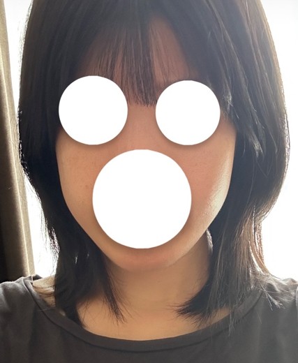 after photo: チタニウムリフト