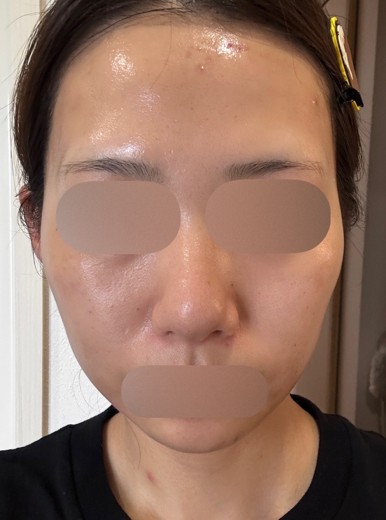 after photo: ルメッカ
