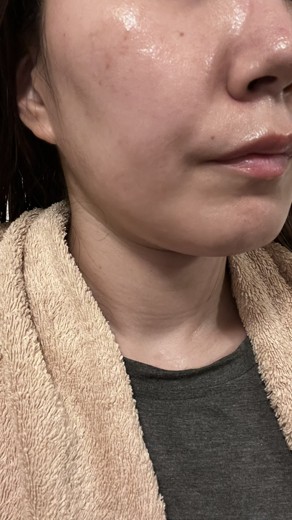 after photo: ジュベルック(Juvelook)