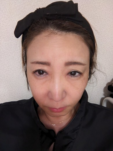 before photo: ピーリング