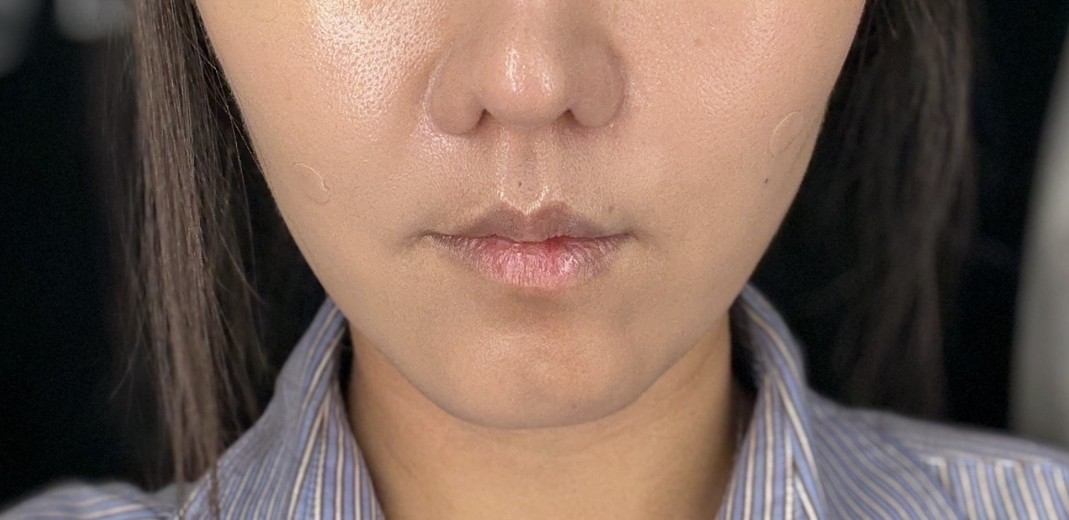 after photo: 쥬베룩