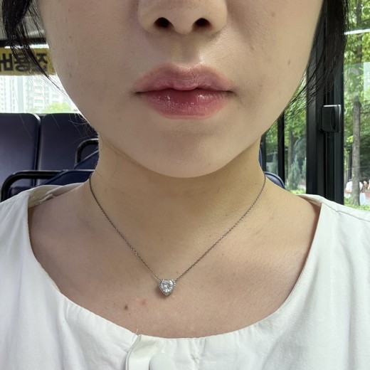 after photo: 사각턱보톡스