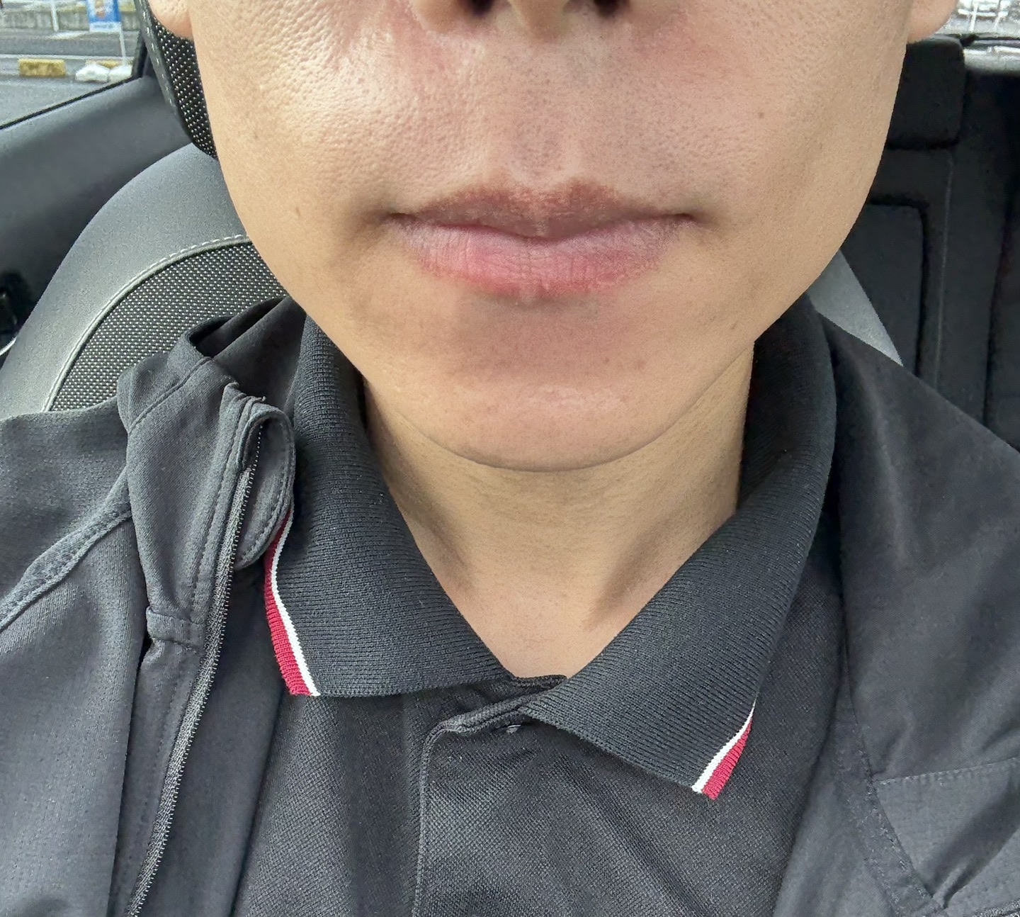 何度でも可】【男性限定】ヒゲ脱毛（髭全体）｜ジェントルマックスプロ