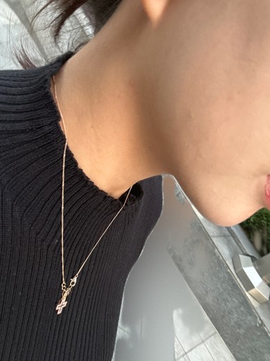 before photo: 침샘보톡스