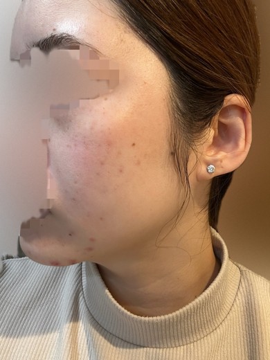 after photo: 診断・検査