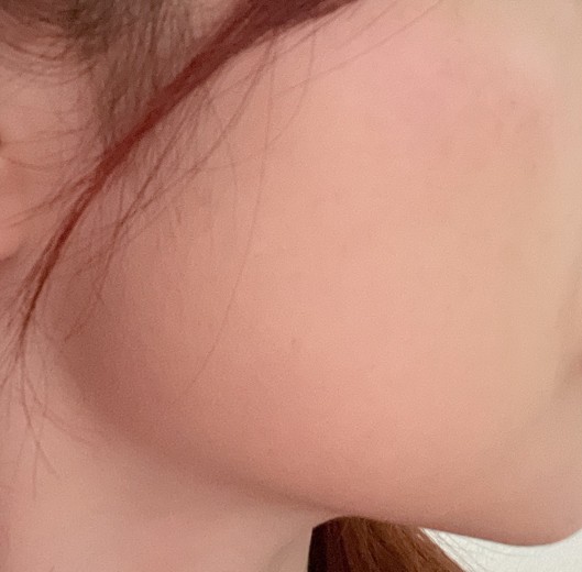 before photo: ルメッカ