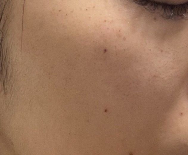 after photo: ルメッカ