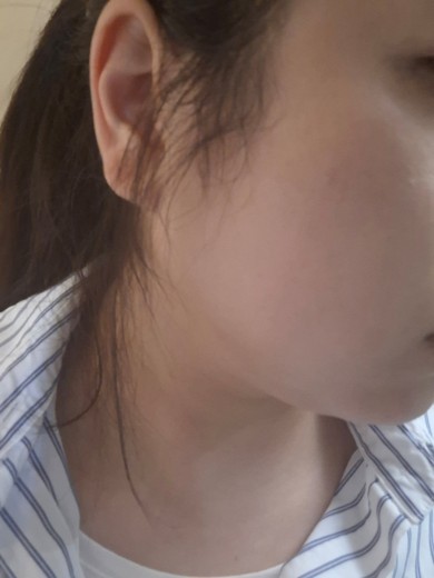 after photo: ルメッカ