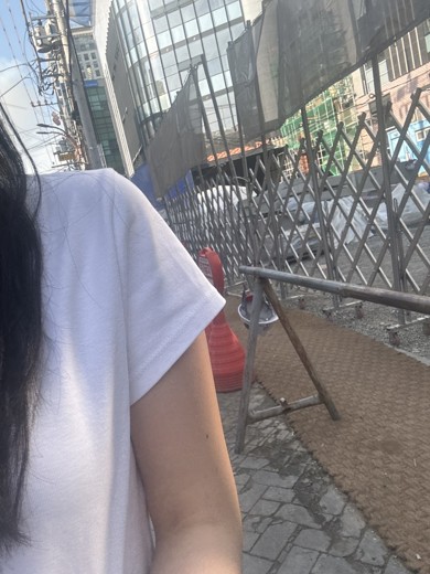 after photo: 팔지방분해주사