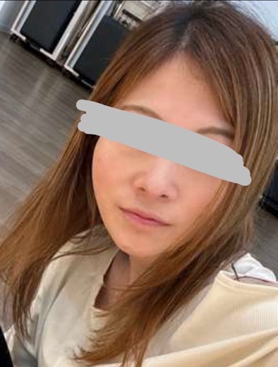 before photo: リジュランヒーラー