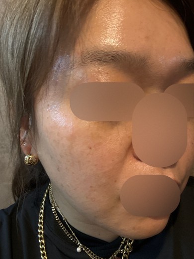 before photo: ルメッカ