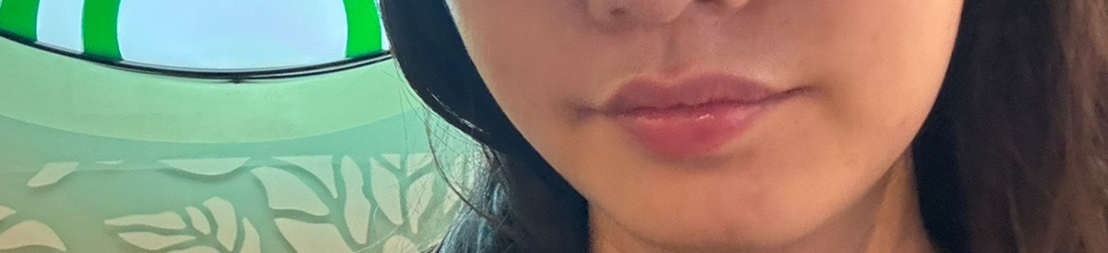 before photo: 피코토닝