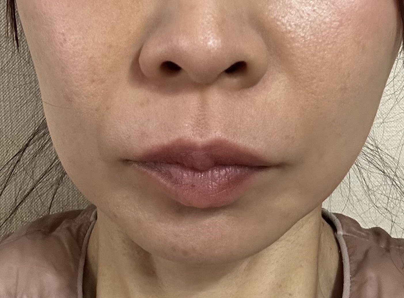 ZX-CLINIC【ゼクスクリニック】 小田 惣也 | カンナムオンニ｜国内利用