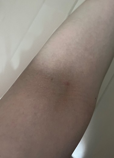 after photo: 白玉注射・点滴, 美容注射・点滴