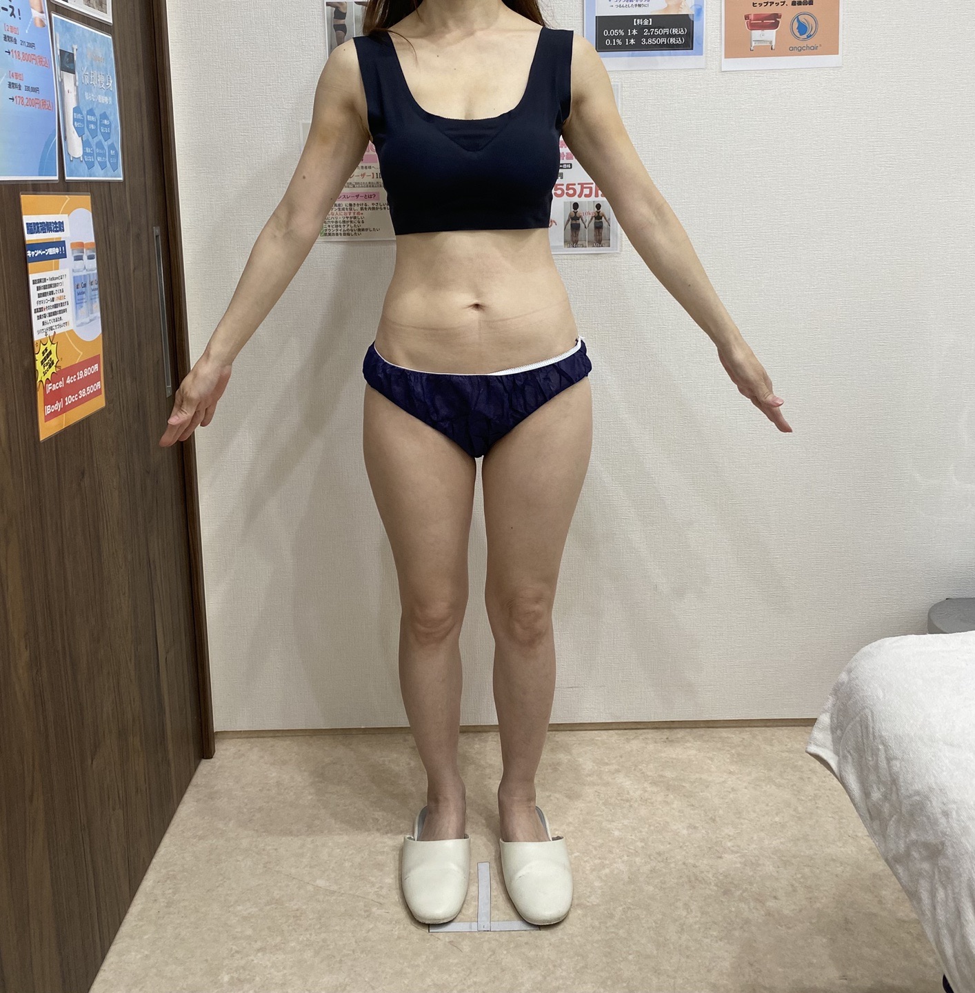 スノエル（脂肪冷却）2パーツ4ハンドル 部分痩せしたい方◎ | オルタ