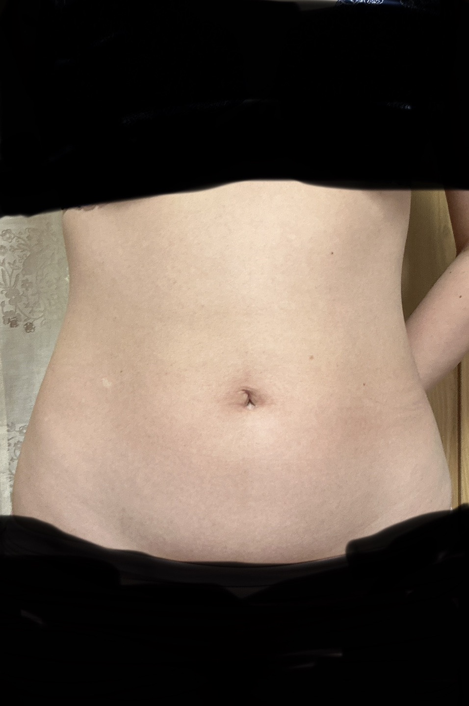 いまだけキャンペーン！冷却　脂肪冷却 2ハンドル いまだけキャンペーン！冷却 脂肪冷却 2ハンドル いまだけキャンペーン