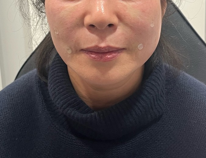 after photo: 쥬베룩