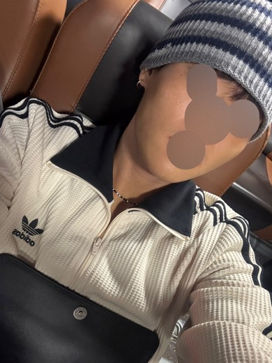 after photo: 사각턱보톡스