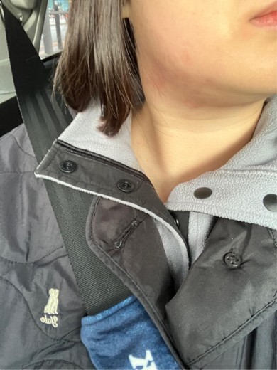 after photo: 인모드리프팅