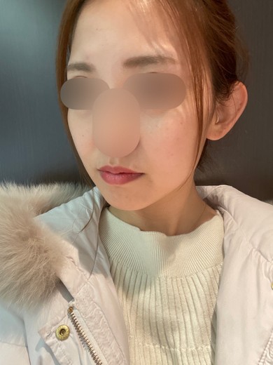 after photo: ソノクイーン(ハイフ)