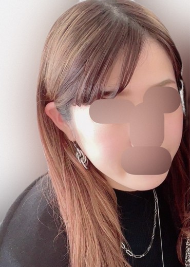 before photo: 糸リフト, あごヒアルロン酸, メーラー/ジョール/バッカルファット除去