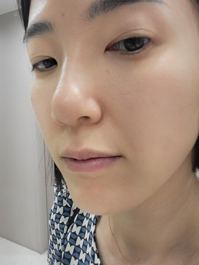 after photo: 쥬베룩