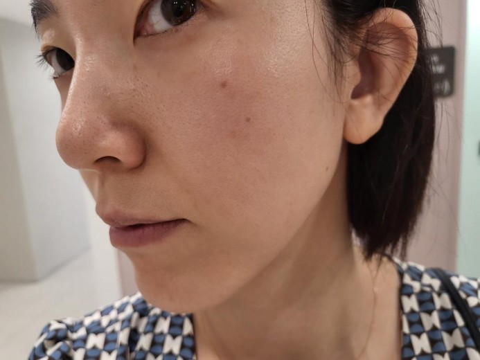 before photo: 쥬베룩