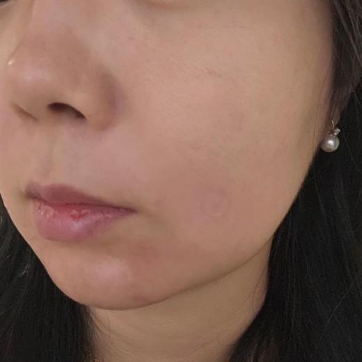 after photo: 쥬베룩