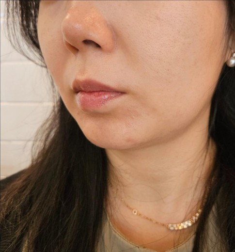 before photo: 쥬베룩