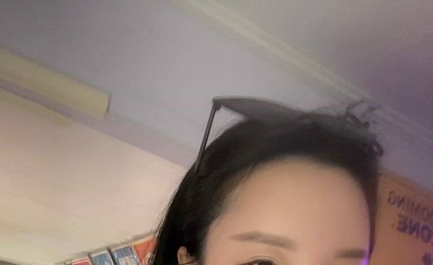 before photo: 이마필러