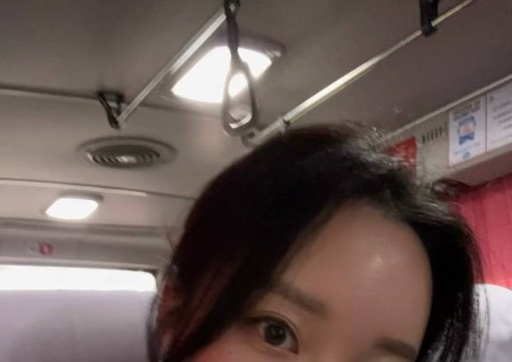 after photo: 이마필러