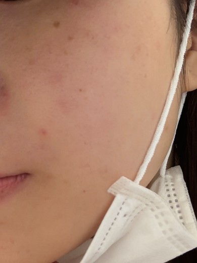 before photo: ルメッカ