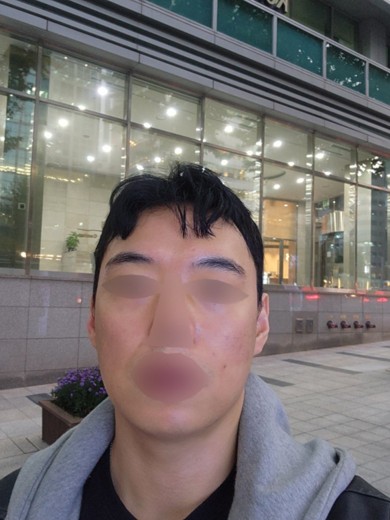 after photo: 슈링크유니버스