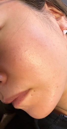after photo: ルメッカ