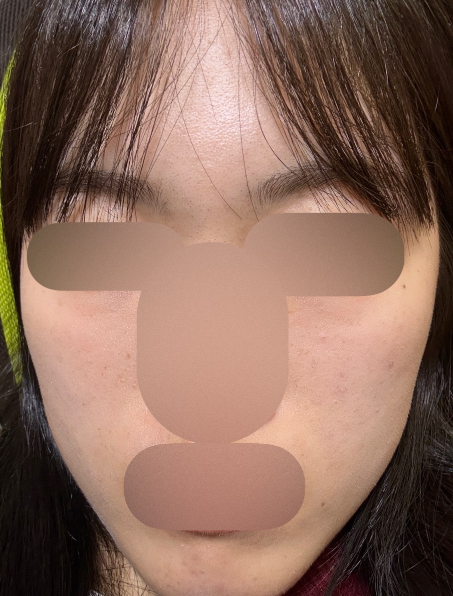 ZX-CLINIC【ゼクスクリニック】の施術口コミ1185件