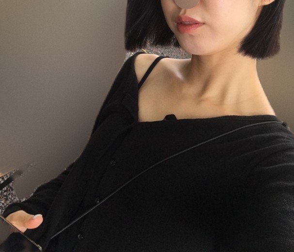 before photo: 턱끝필러