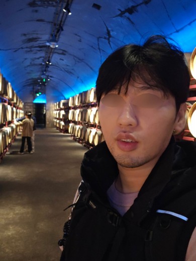 before photo: 아쿠아필링