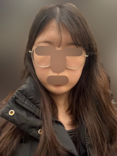 after photo: 슈링크유니버스