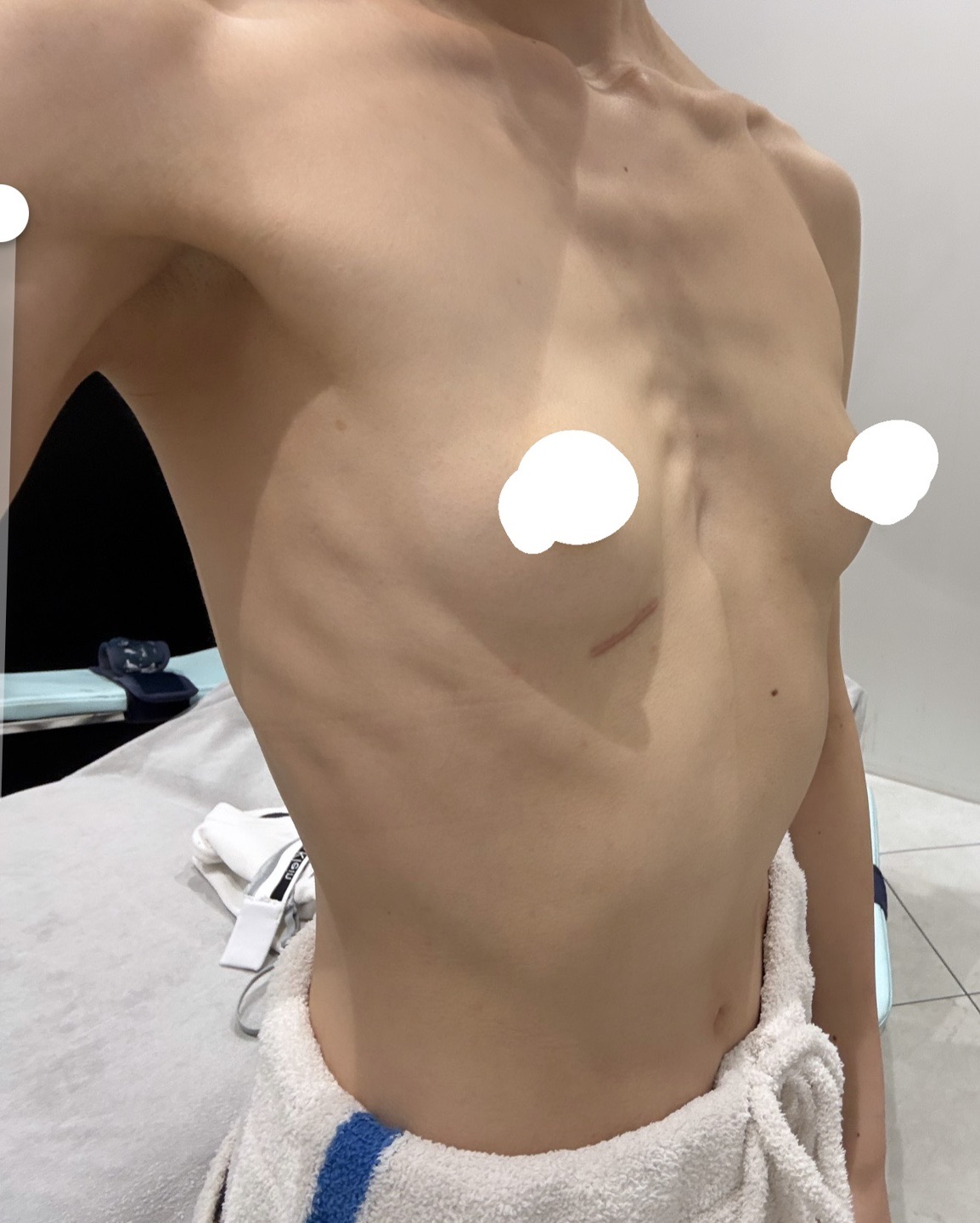 가슴(보형물)の施術・口コミ・クリニック情報(2025) | カンナムオンニ