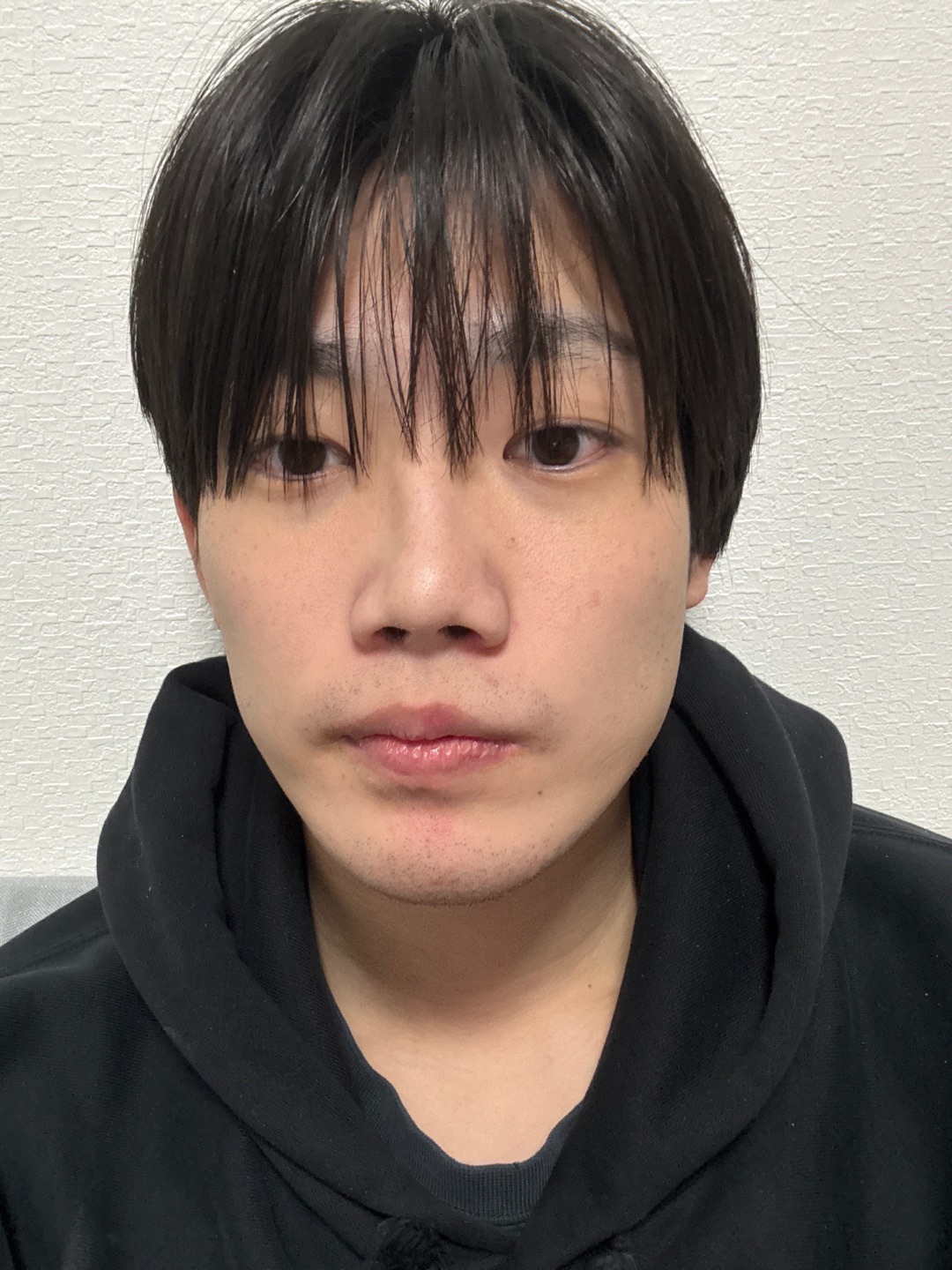 何度でも可】【男性限定】ヒゲ脱毛（髭全体）｜ジェントルマックスプロ
