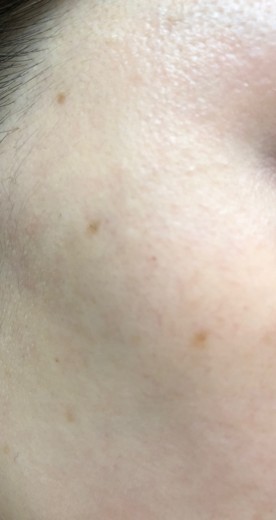 after photo: ルメッカ