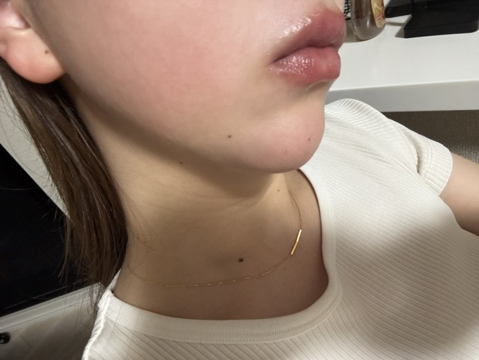 before photo: リニアファーム(ハイフ)